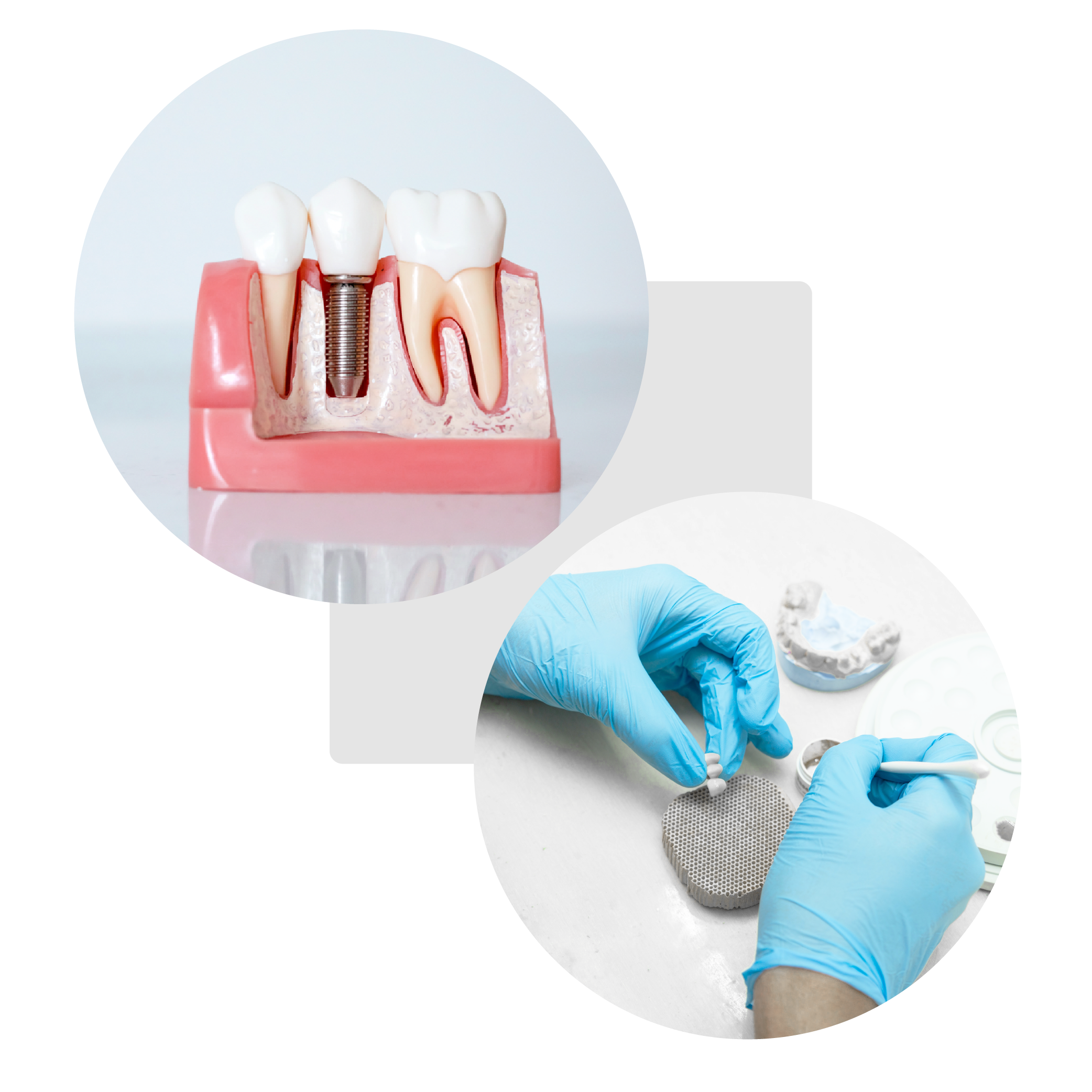 curso de implantología madrid y valencia