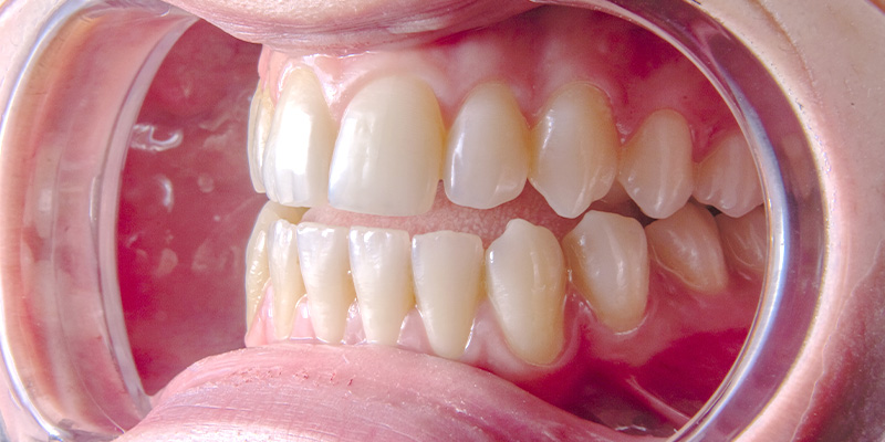 Curso de cirugía oral en línea