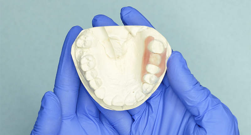 Curso iimplantoprótesis