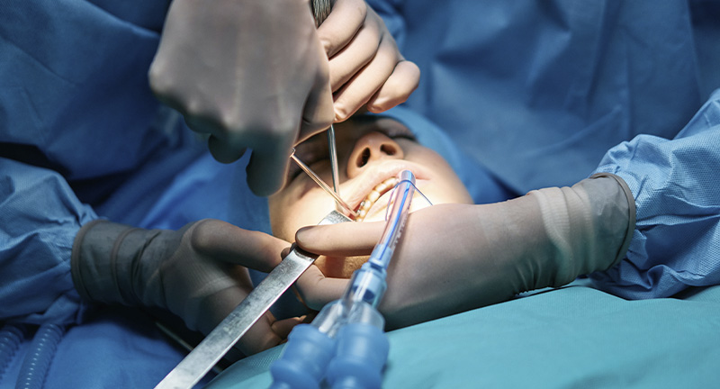 Sedación y Anestesia curso cirugía dental avanzada