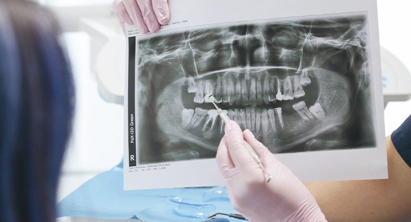 Curso de Cirugia técnicas de regeneración 